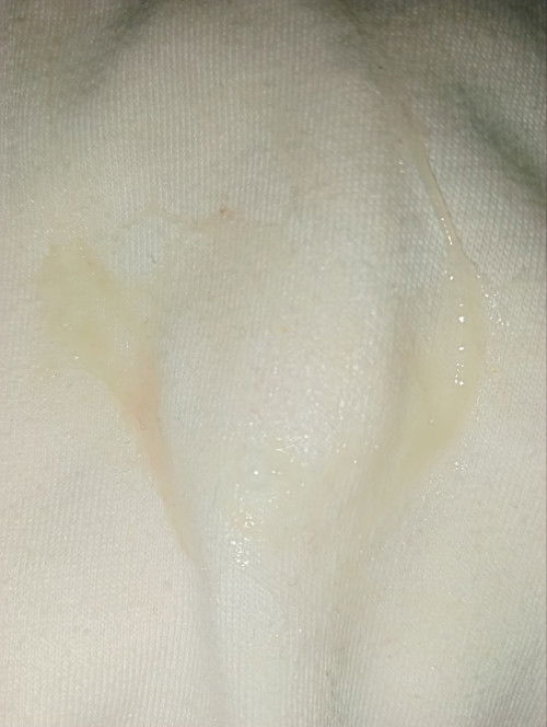 Mucus Plug na ba to?