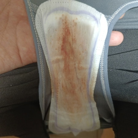 Nak tahu normal ke tak?