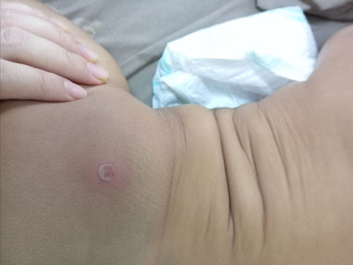 Tahu tak knpe.jadi mcm nie?Hari nie nampak dah besar,ade krim APA apa xkena letak?atau direct klink?