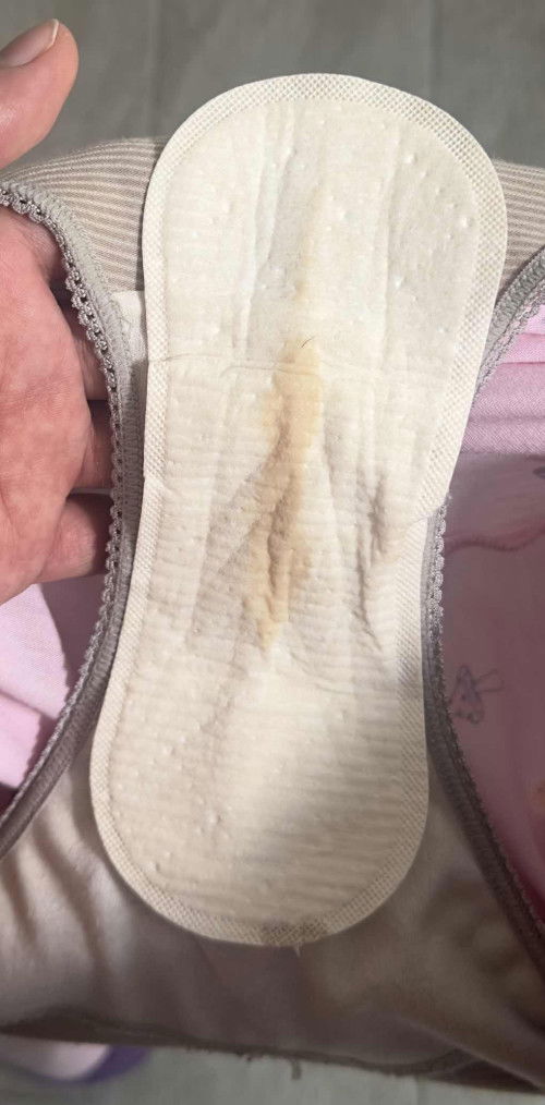 Smell blood discharge in 38weeks