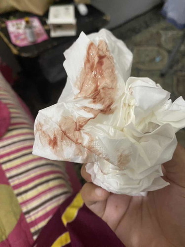 BLEEDING BROWNISH