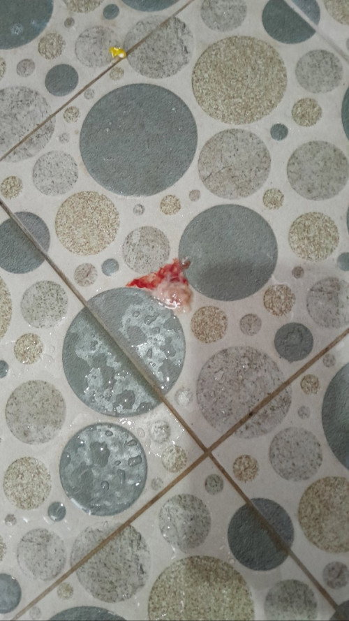 Keluar lendir campur darah