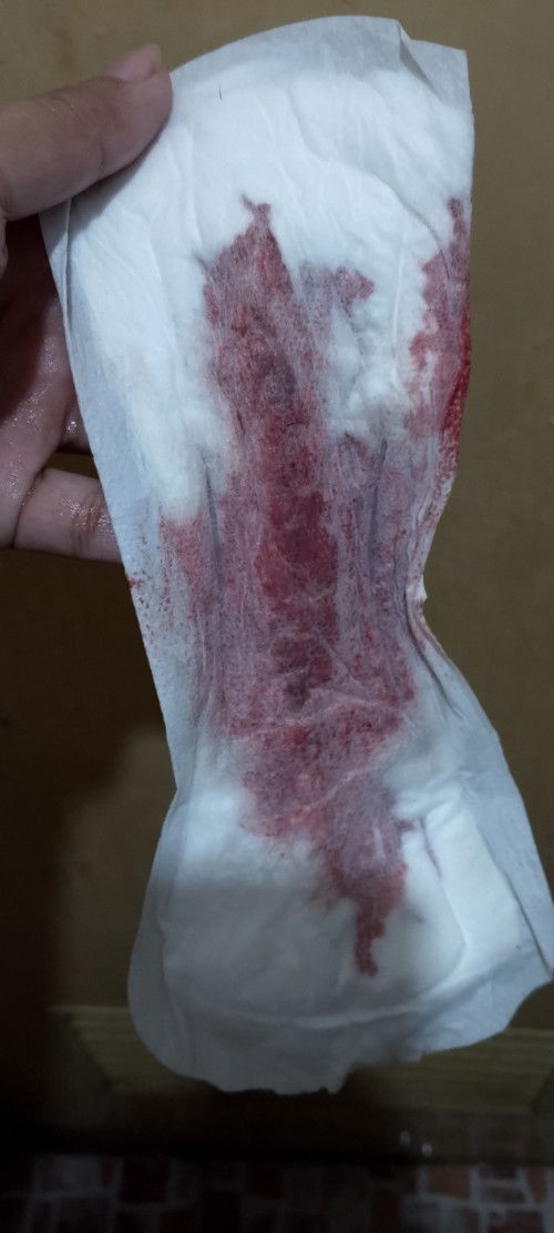 Unang period after manganak: Ask ko lang po kung mens na po ba ito? See picture attached.