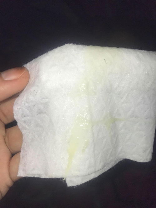 hello po.normal lang poba sa 37 weeks and 2 days pregnant na may lumabas po na ganto?first baby kopo