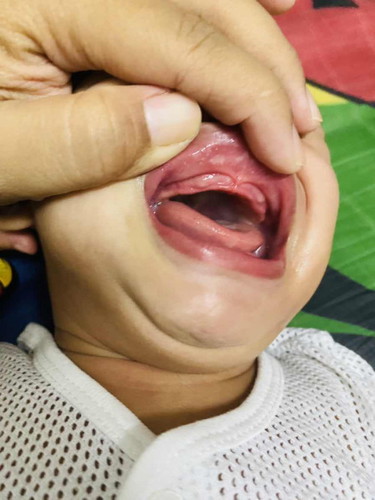 Baby 10 bulan tumbuh gigi siung…