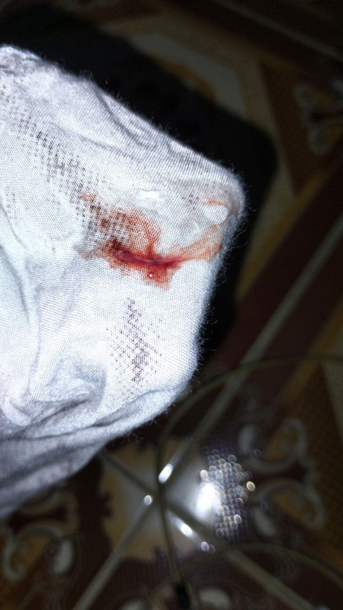 Khamilan 38mgg 3hri
Dri smlem jm 10 skit perut bngt kayak mau haid sampe skrng masih
Trs kluar drh