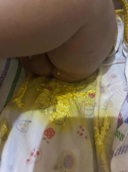 Pup bayi spt ini normal kh??