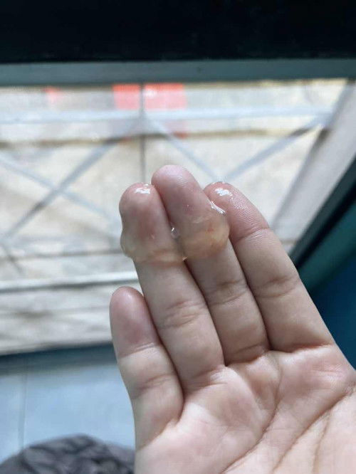 สอบถามค่ะแม่ๆ