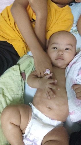Kulit bdan