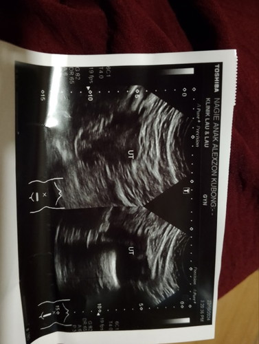 Scan bawah perut
