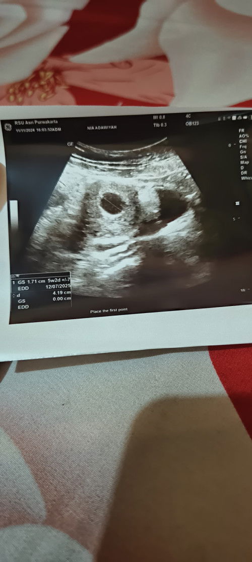 Hamil 8 minggu