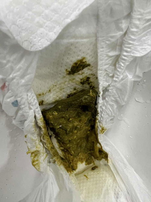 Baby perlu berak hari2 ke ?