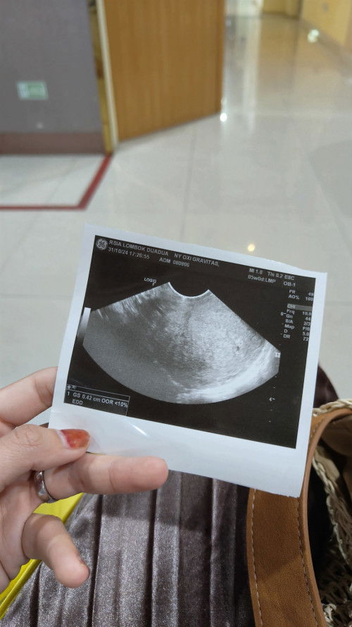 Bunda bundaa mau tanya dongg soal mual2 saat hamil