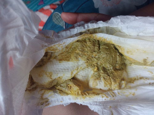 กินนมผงผสมกับนมแม่