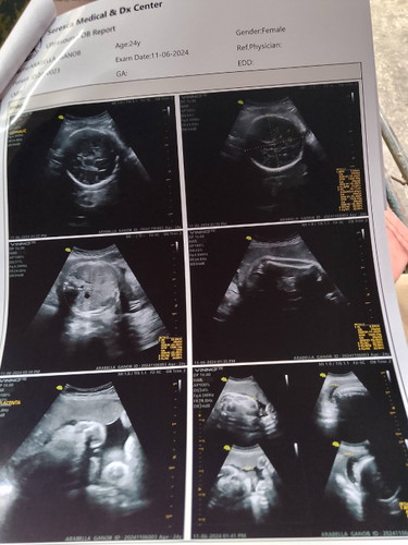 Ang due date kopo ay January 19 2025 hindi pa po ba sure Yun? 40 weeks po kasi ang Jan 19 duedate