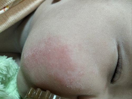 สอบถามแม่ๆค่ะ