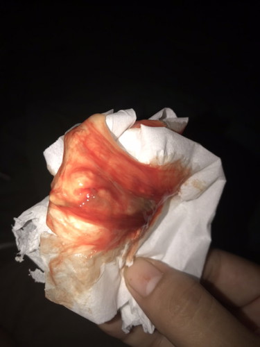 Sign na po ba to na manganganak na?