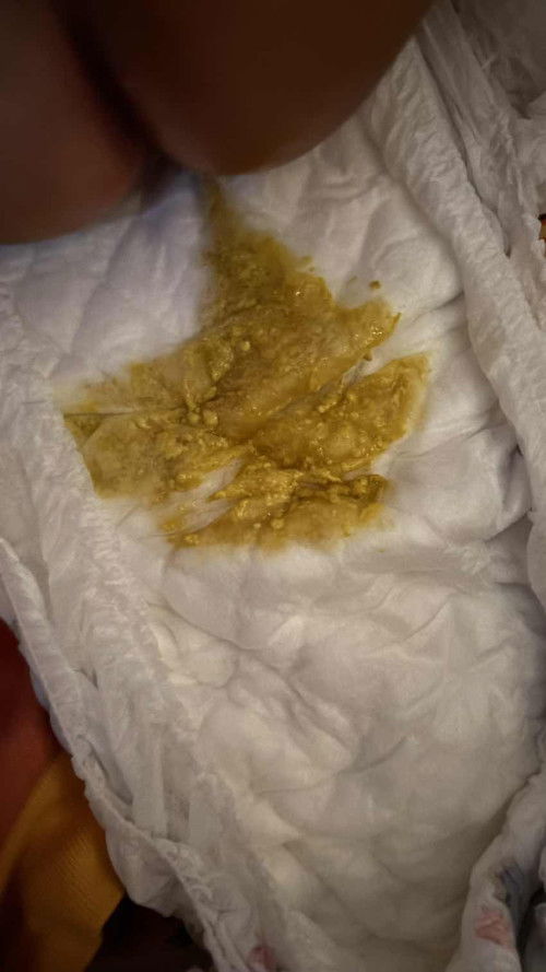 Pup bayi 3 bulan 21 hari