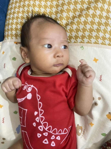 Garis bando pada kepala bayi