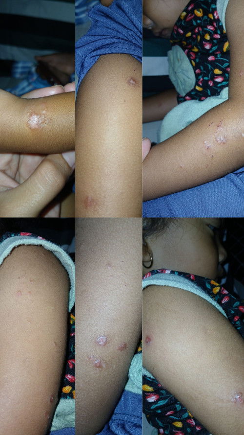 Assalamualaikum bunda bunda 
Izin bertanya i