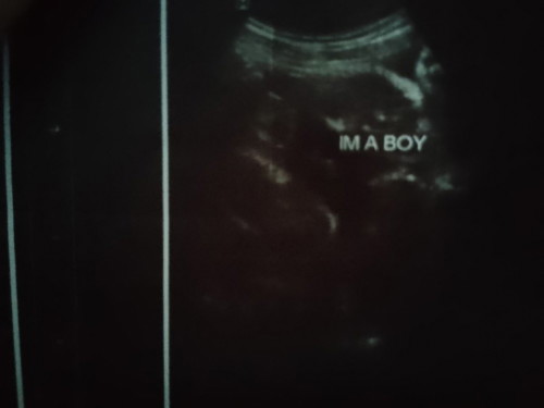 malinaw po ba na boy po ang gender ng baby ko po