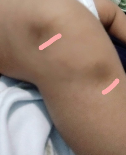 Tanda hitam di kaki bayi Newborn
