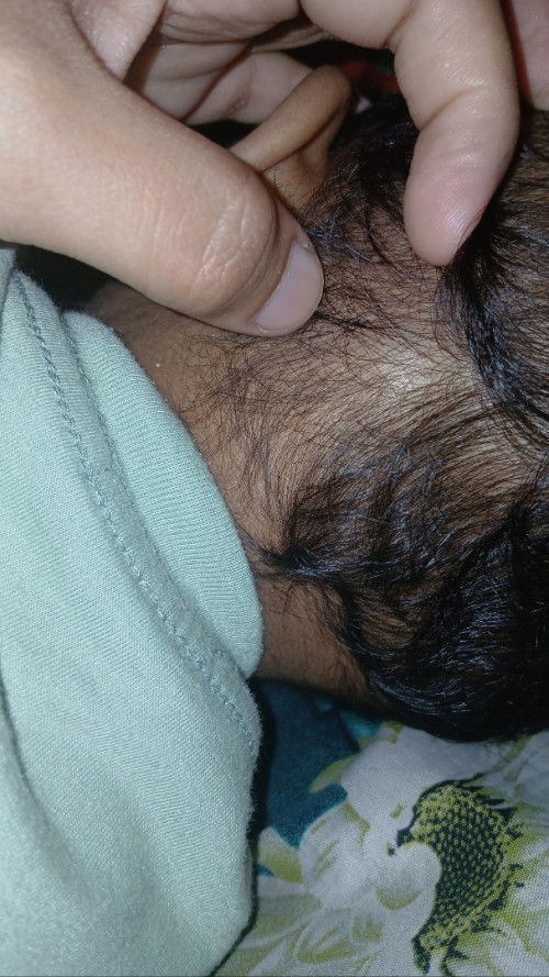 Benjolan pada belakang kepala