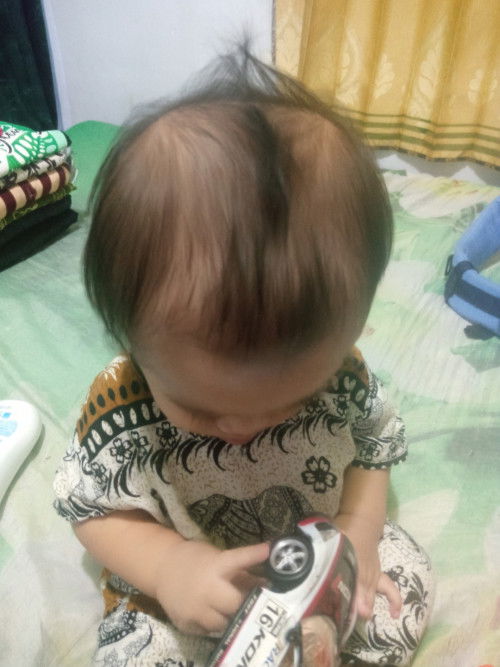 Bagaimana ciri adhd atau autis