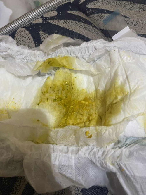 Pup begini gpp ga ya