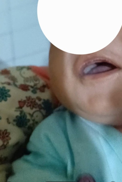 Di gusi atas