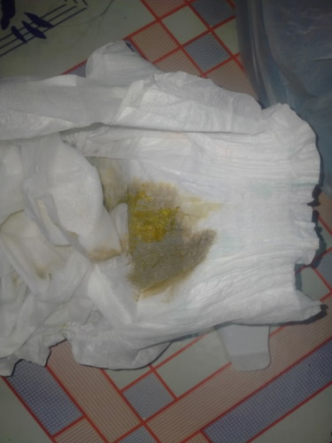 Mga mommy any idea po kung normal lang poop ni baby formula feed na kasi sya please pasagot po