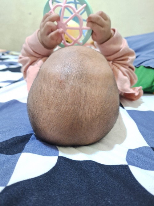 Kepala peyang umur 4.5bulan