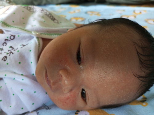 Wajah baby ada bintik² kira² kenpa ya bun? Ada yg tau gak cara untuk hilangin nya