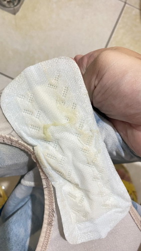 Mucus plug