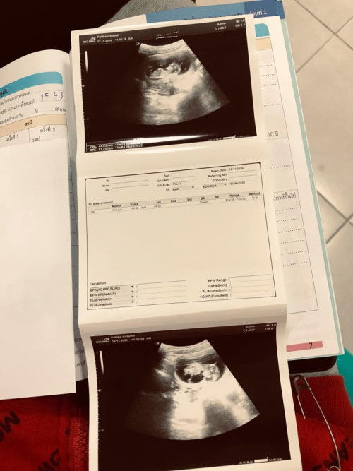 ขออนุญาตนะคะ