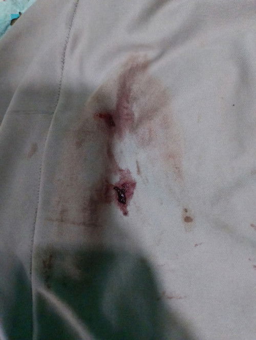 Flek hamil/menstruasi terlambat