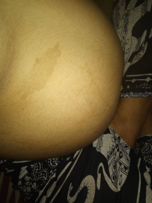 ท้องต่ำท้องแข็งเยี่ยวปริบปวดหลังเสียวจิ'มิ