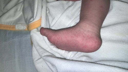 สอบถามเเม่บ้านไหนพอรู้บ้างคะ