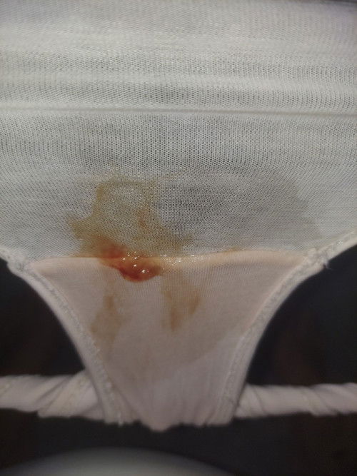 Mga mommies  punta nabako ng hospital