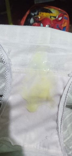 Keputihan apa bukan?