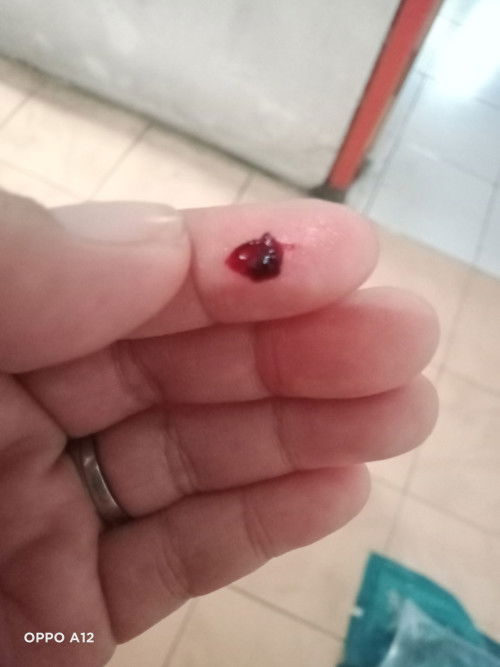 Kehamilan yg ngeflek