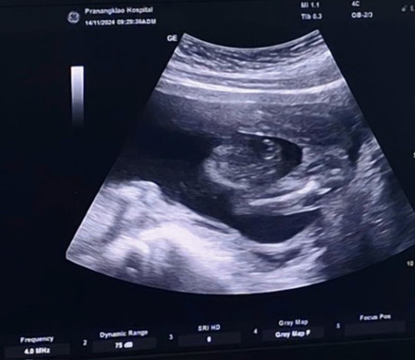 สอบถามน้ำหนักกับเพศน้อง