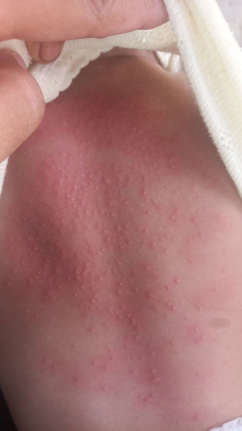 Obatnya apa ya bunda