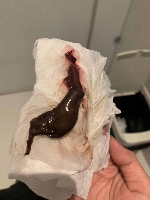 Bun aku keguguran ga ya?