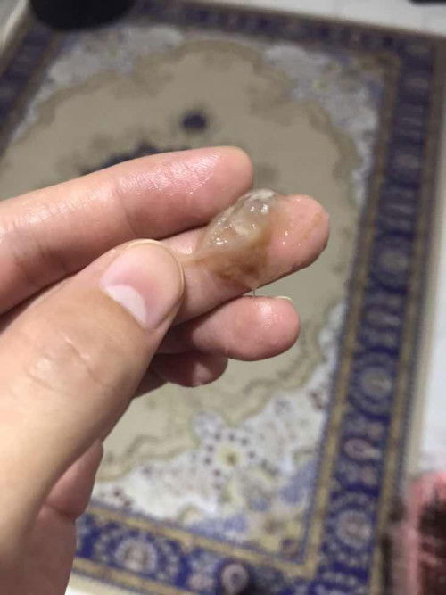 Lendir keluar 34 minggu