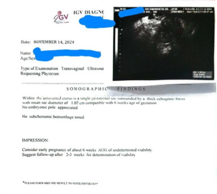 Mga maderrrr ano na kaya yaaaan. TIA po sa sasagot. May chance ba mag tuloy ang pregnancy?