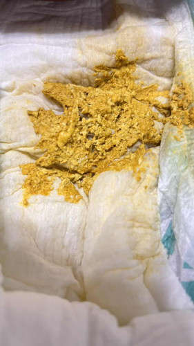 Is this normal poop for 2months old formula feed?
