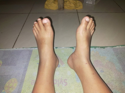 Bunda bunda mau tanya,ini termasuk bengkak tidak ya kaki saya?