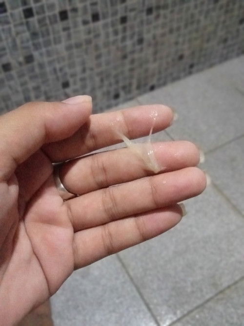 Mucus plug na Po ba ito? @37 weeks and 3dys  na Po Ako naninigas na din tyan ko at sumskit ang puson