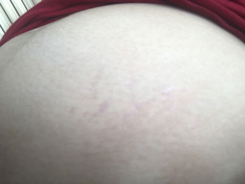 ถามแม่ๆหน่อยค่ะขออนุญาตค่ะ